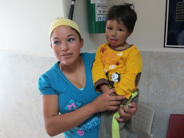 Mexico: CaboSmiles Mission – Correcting Cleft Lips and Palate Deformities
