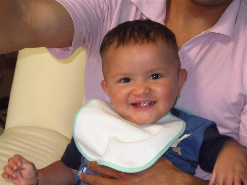 Mexico: TecateSmiles Mission – Mexico: CaboSmiles Mission – Correcting Cleft Lips and Palate Deformities