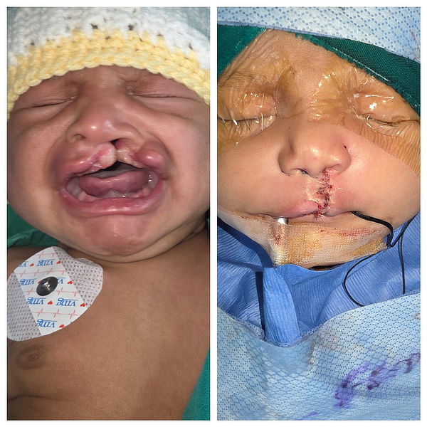 Report from Smiles International Mission to Costa Rica April 2026